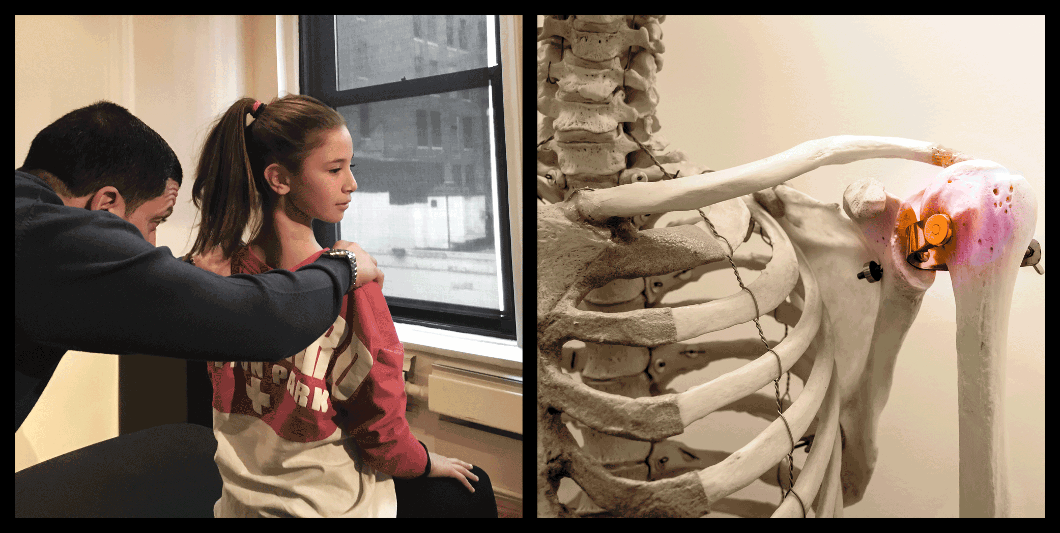 9 Steps to Strong Bones: Taking calcium supplements is NOT one of them.